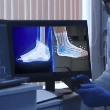 Medias De Compresión - Obtén Alivio Instantáneo De Pies Hinchados Y Adoloridos